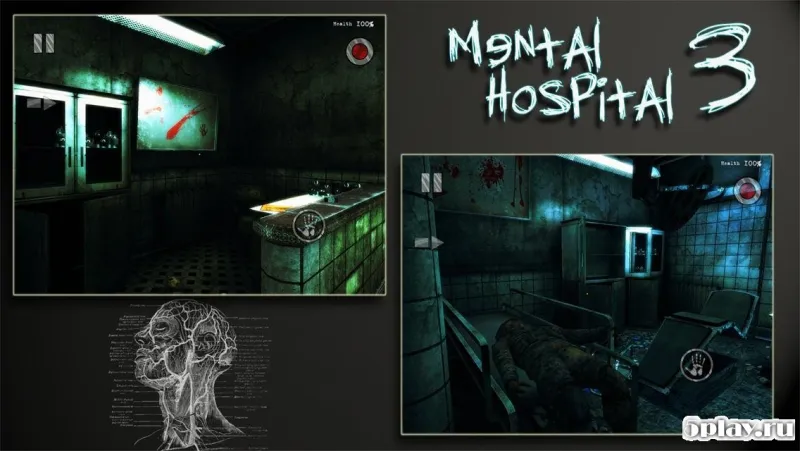 Mental Hospital III HD screenshot 1