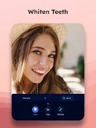 Teeth Whitener: Lips Plumper screenshot