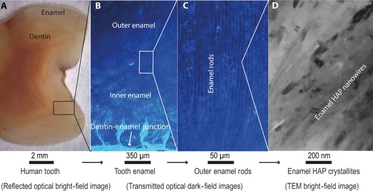 Вчені створили ультра -стійкий штучний зубний емаль